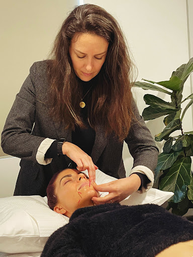 Cosmetic acupuncture and skin needling Melbourne