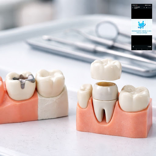 If a damaged tooth keeps troubling you, a simple filling may not always be the safest long-term s…