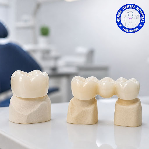 Confused between crowns and bridges? At VERMA DENTAL HOSPITAL - Braces & Implant Centre, we make… post image