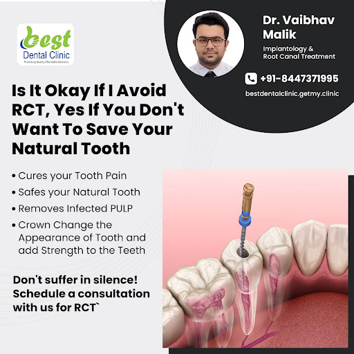 Root canal treatment (endodontics) is a dental procedure used to treat infection at the centre of… post image