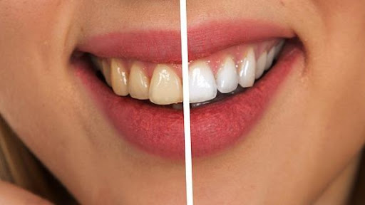 Clínica Dental Jesús Bilbao Anitua - Spain
