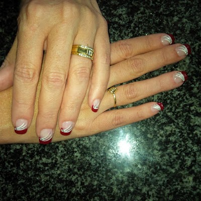Photos of Elzabe's Hands and Nails