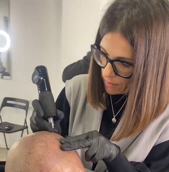 Micropigmentación capilar Cádiz