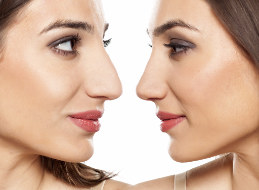 East Bay Plastic & Reconstructive Surgery