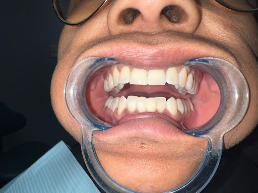 Perla Dental - Desoto - Thumbnail