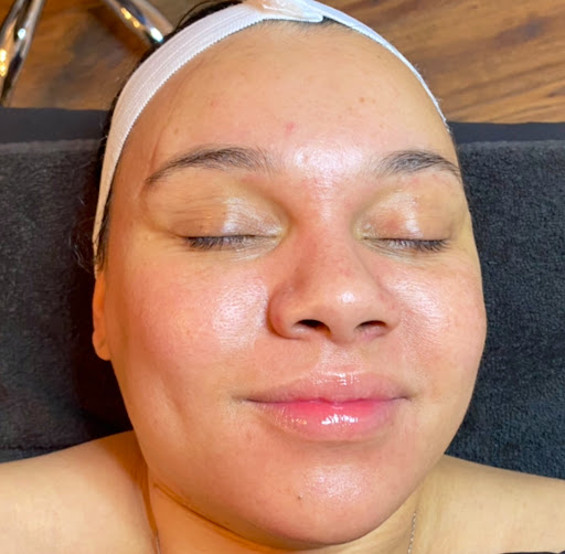 Angel Glō Skincare - Thumbnail