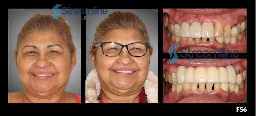 Bird Rock Dental La Jolla - Thumbnail