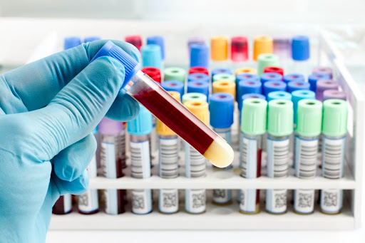 “Get Hassle-Free Blood Test Home Collection in Noida & Greater Noida – Thyrocare”
