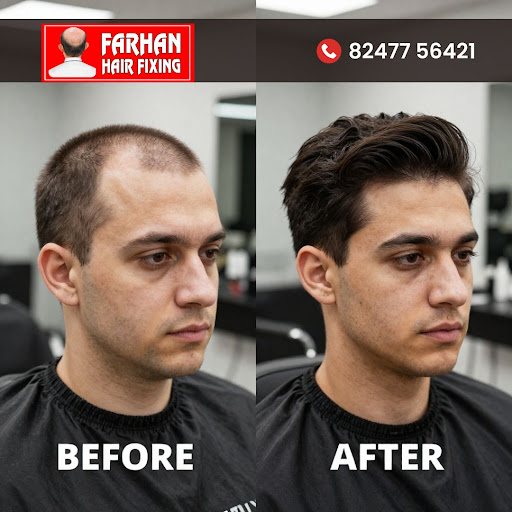 How to Choose the Right Non surgical Hair replacement Solution for Your Needs… post image