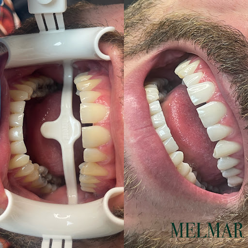 Melmar Face & Brows - Thumbnail