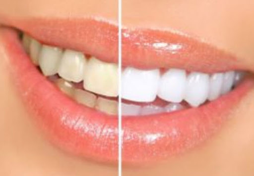 ProSmiles Dentist Collingwood - Thumbnail