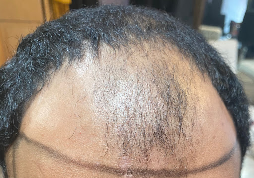 Sho Ouf International Hair Replacement Studio - Thumbnail