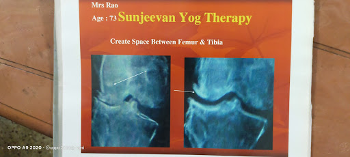 Post covid restart your work for knee post image
