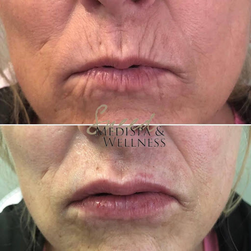 Sneed MediSpa