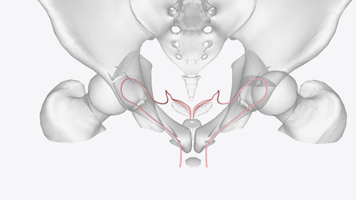 Pelvic lymph node dissection is a surgical procedure used to assess and manage conditions affecti… post image