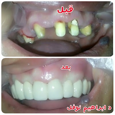 Photos of Dental Center Dr Nofal