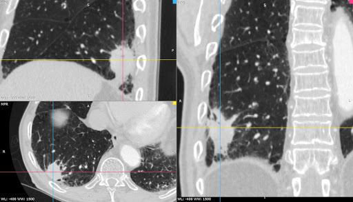 Praktyka Lekarska Pulmonolog dr hab. n. med. Piotr Korczyński