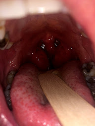 Photo n°20 de Docteur Bruno LELLOUCHE. Clinique du Mont-Louis. Chirurgie ORL.. Sommeil à Paris (Clinique du sommeil)