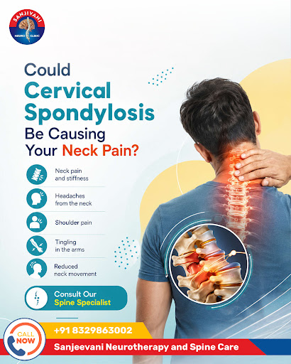 Cervical Spondylosis post image