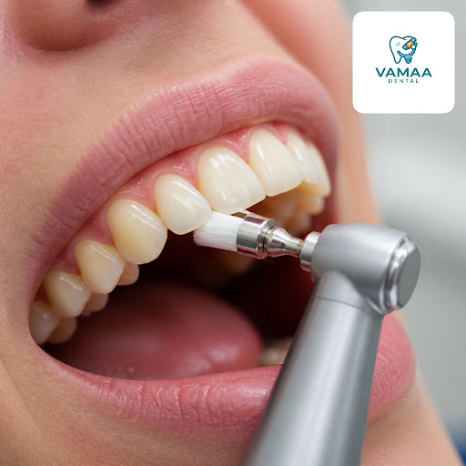 Want a brighter, fresher smile without damaging your enamel? At Vamaa Dental Clinic and Microscop… post image
