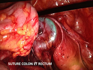 Photo n°2 de Dr Frédéric Martin à Épinal (Clinique)