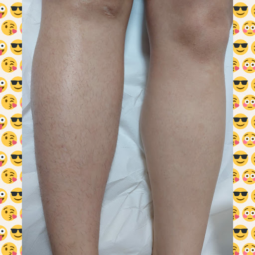 Vitas Waxing Lounge