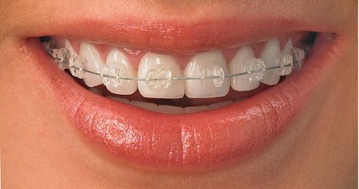 Dr Augustin Chavanne - exercice limité à l'Orthodontie Gallery - France