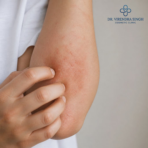 Dealing with itchy rashes, redness or recurring skin allergies? Get precise diagnosis and gentle,… post image
