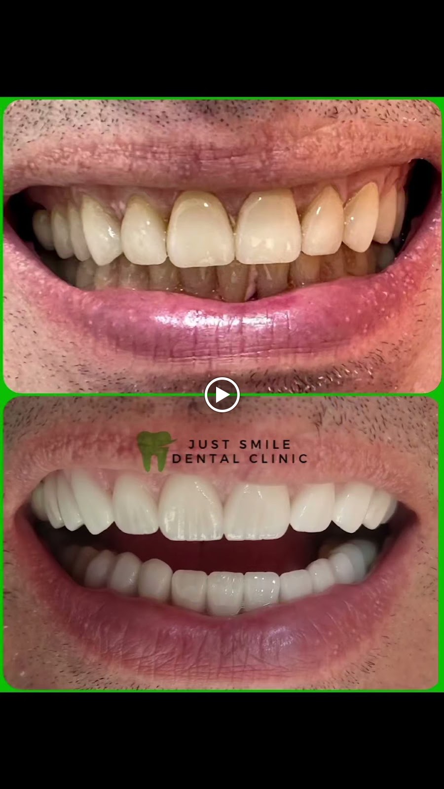 Just Smile Dental Clinic عيادة جست سمايل لطب الأسنان - صورة 3