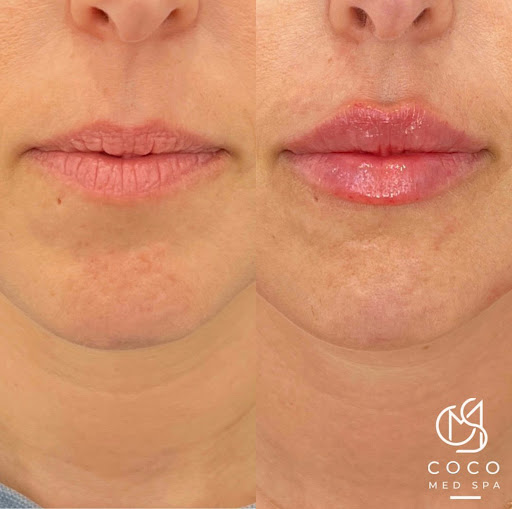 Coco Med Spa