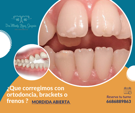 Dental Office Los Mochis - Thumbnail
