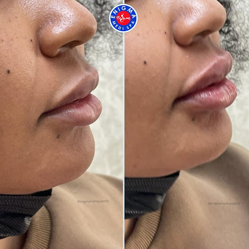 Enigma Plastic Surgery