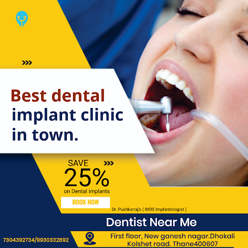 Save 25% on dental implants post image