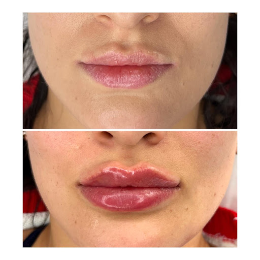 Elixir Med Spa - Visual