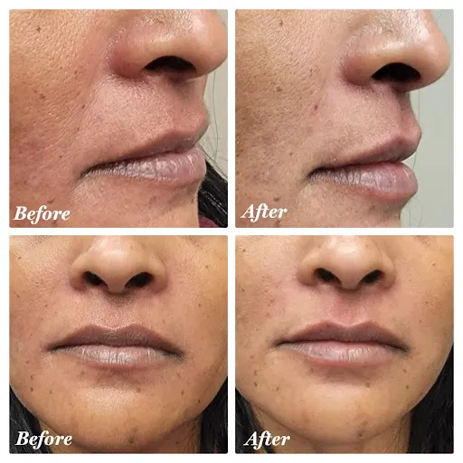 Royal MedSpa - Thumbnail