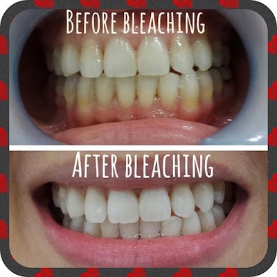 Photos of Elite Dental Clinic