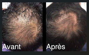 Photo n°7 de Institut de beauté, soins du visage et massages bien-être à Bandol - Jouvence 83 à Bandol (Institut de beauté)