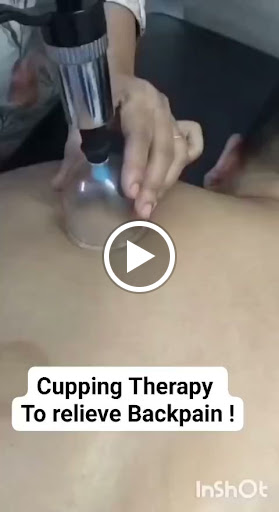 Cupping Physiotherapy & Pain Relief Clinic in Sector 12 Noida post image