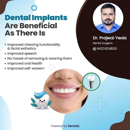 Do implant for missing teeth post image