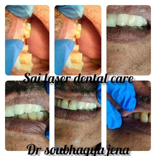 #best dental services #Rourkela dentist# Dental clinic #capping// root canal treatment #dental br… post image