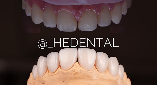 Clínica HEDental Gallery - Mexico