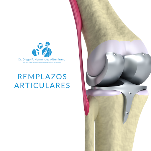 Traumatólogo | Ortopedista Dr. Diego Pablo Hernández Altamirano - Thumbnail