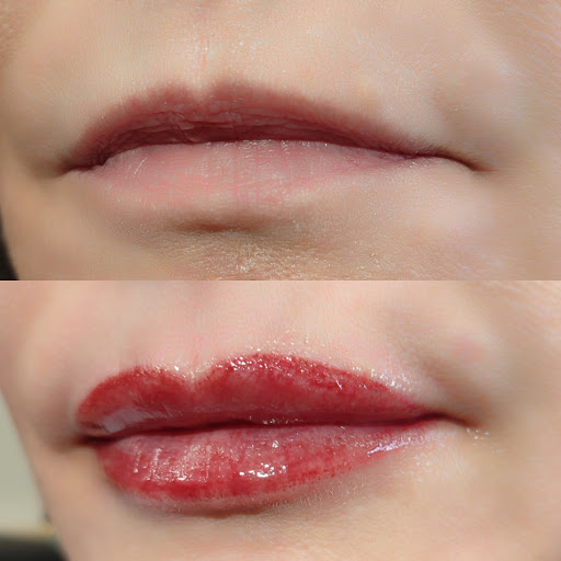 Belén Estética - Thumbnail