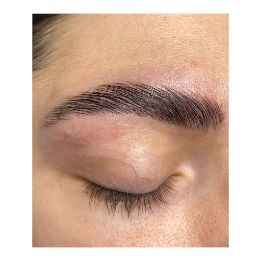 Estetica Calipso Epil Center - Thumbnail