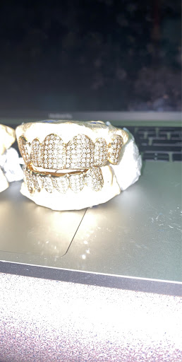Gold 4 Ya Mouth - Thumbnail