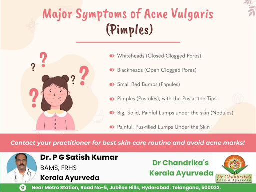 Acne vulgaris symptoms include blackheads, whiteheads, pustules, and cysts, often caused by oil a… post image