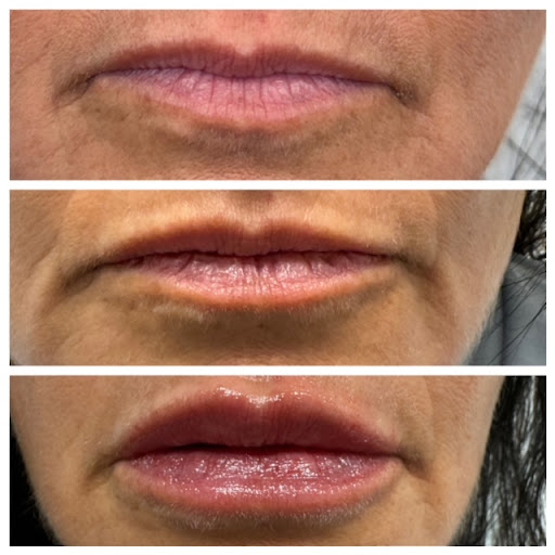 Melt Medspa