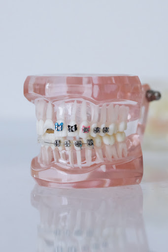 Studio Dentistico Gerevini - Thumbnail