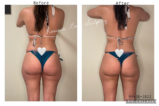 Roxanne Body Sculpting LLC - Thumbnail