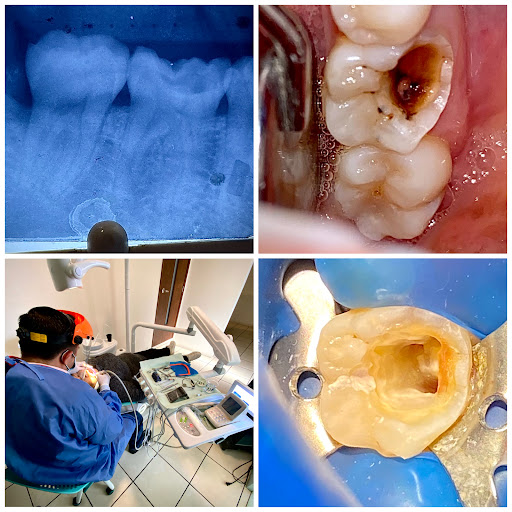 Cirujano dentista Jafet Jiménez (dentaliving) - Thumbnail